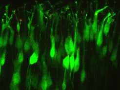 Primary cilia (red) of migrating newborn neurons (green) in the developing cerebral cortex.